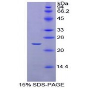 SDS-PAGE analysis of Horse Interleukin 1 beta Protein.