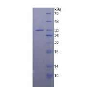 SDS-PAGE analysis of Human IRAK2 Protein.