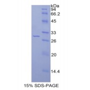 SDS-PAGE analysis of Rat IRAK2 Protein.