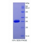 SDS-PAGE analysis of Human IRAK3 Protein.