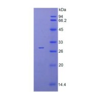 SDS-PAGE analysis of Human IRAK4 Protein.