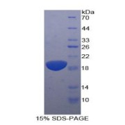 SDS-PAGE analysis of Human IL11Ra Protein.