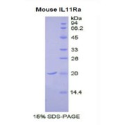 SDS-PAGE analysis of Mouse IL11Ra Protein.