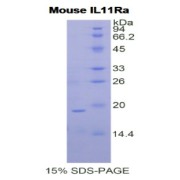 SDS-PAGE analysis of Mouse IL11Ra Protein.