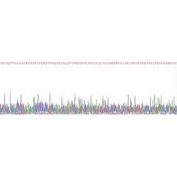 Human Interleukin 18 Binding Protein (IL18BP) Protein