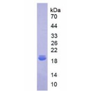 SDS-PAGE analysis of recombinant Human IL18BP Protein.