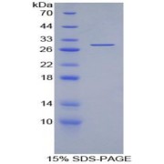 abx067502