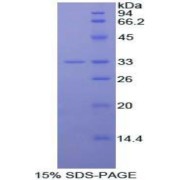 SDS-PAGE analysis of Mouse IL20Ra Protein.