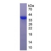 SDS-PAGE analysis of recombinant Human Islet Cell Autoantigen 1 (ICA1) Protein.