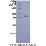 SDS-PAGE analysis of recombinant Mouse Jagged 2 Protein.