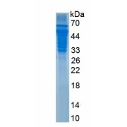 SDS-PAGE analysis of recombinant Human Jagged 2 Protein.