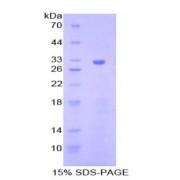 SDS-PAGE analysis of Mouse Janus Kinase 1 Protein.