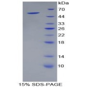 SDS-PAGE analysis of recombinant Mouse Kallikrein 4 Protein.