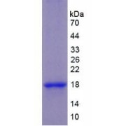 SDS-PAGE analysis of Human Keratin 1 Protein.