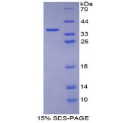 SDS-PAGE analysis of Mouse Keratin 1 Protein.