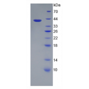 SDS-PAGE analysis of recombinant Human Keratin 10 Protein.