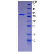 SDS-PAGE analysis of recombinant Human Keratin 18 Protein.