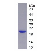 SDS-PAGE analysis of recombinant Rat Keratin 2 (KRT2) Protein.