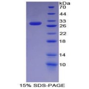 SDS-PAGE analysis of Mouse KHDRBS1 Protein.