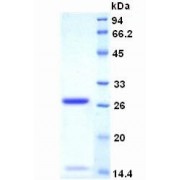 SDS-PAGE analysis of Human Ki-67 Protein.