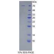 SDS-PAGE analysis of recombinant Human Killer Cell Immunoglobulin Like Receptor 2DL2 KIR2DL2 Protein.