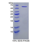 SDS-PAGE analysis of Human KIR3DL1 Protein.