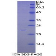 SDS-PAGE analysis of Human KLRC2 Protein.