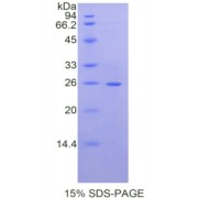 SDS-PAGE analysis of Mouse Laminin beta 2 Protein.
