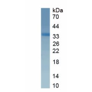 SDS-PAGE analysis of recombinant Rat Laminin gamma 1 Protein.