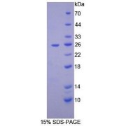 SDS-PAGE analysis of recombinant Human Leucine Aminopeptidase Protein.