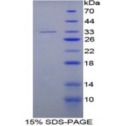 SDS-PAGE analysis of Rat LRG1 Protein.