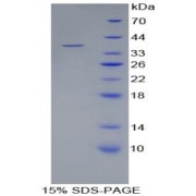 SDS-PAGE analysis of Human LRG1 Protein.