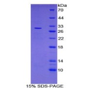 SDS-PAGE analysis of Mouse LRRC32 Protein.