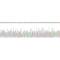 Human Leucine Rich Repeat Kinase 2 (LRRK2) Protein