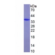 SDS-PAGE analysis of recombinant Mouse LRRK2 Protein.