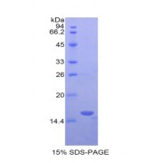 SDS-PAGE analysis of Human LAIR2 Protein.