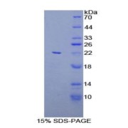 SDS-PAGE analysis of Rat LAT2 Protein.