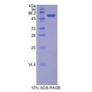 SDS-PAGE analysis of Human BSDL Protein.