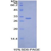 SDS-PAGE analysis of Human Lipase, Endothelial Protein.