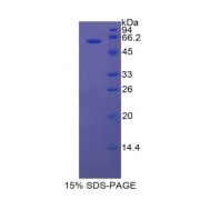 SDS-PAGE analysis of Rat Lipase, Hepatic Protein.