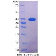 SDS-PAGE analysis of Rat Lipase, Pancreatic Protein.