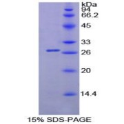 SDS-PAGE analysis of Mouse Lipase, Pancreatic Protein.