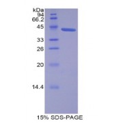 SDS-PAGE analysis of recombinant Human Lipocalin 12 Protein.