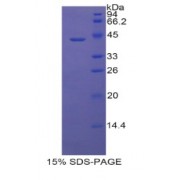 SDS-PAGE analysis of Rat Lipocalin 6 Protein.