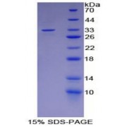 SDS-PAGE analysis of recombinant Rat LBP Protein.
