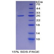 SDS-PAGE analysis of Human Lumican Protein.