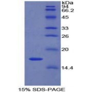 SDS-PAGE analysis of Rat LYAR Protein.