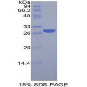 SDS-PAGE analysis of Mouse LAG3 Protein.