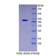 SDS-PAGE analysis of Human Lnk Protein.