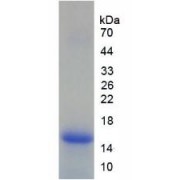 SDS-PAGE analysis of recombinant Human Lymphocyte Antigen 96 (LY96) Protein.